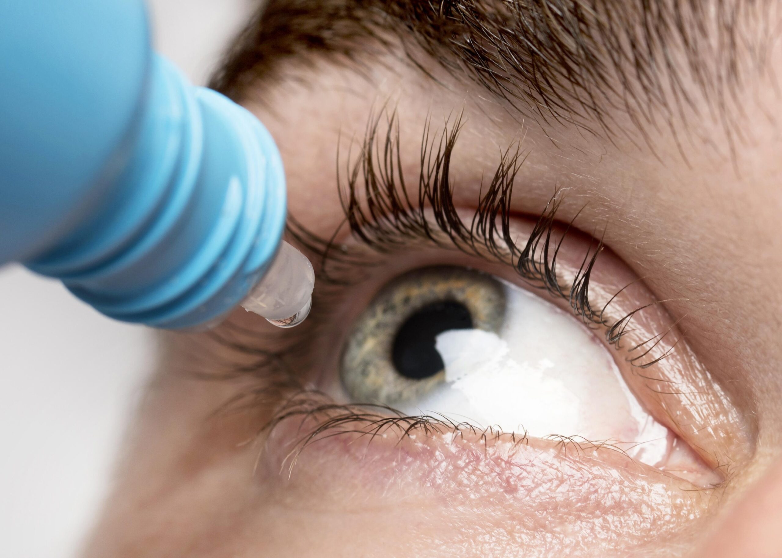 Keratoconus Treatment Specialist in Dubai