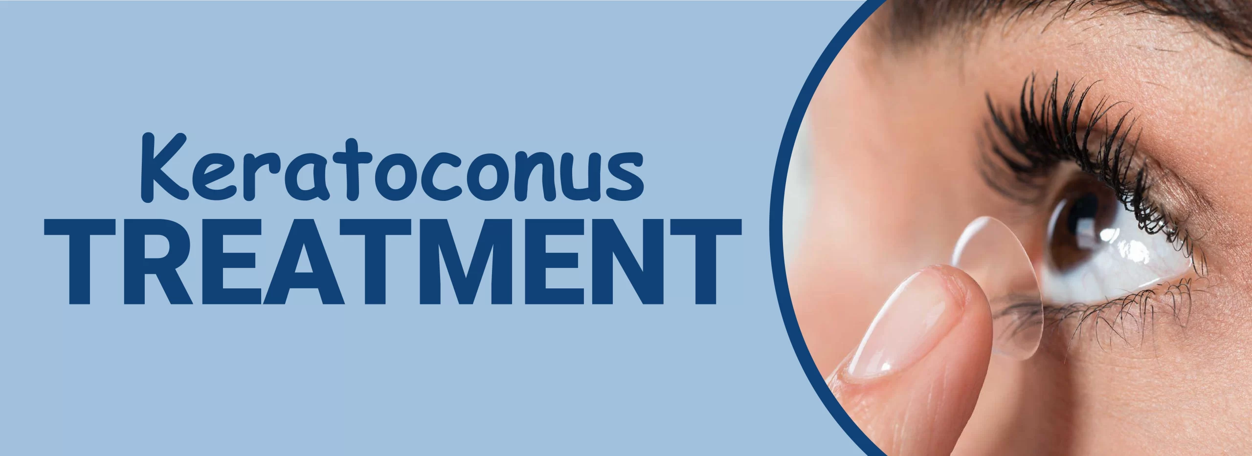 Keratoconus Treatment