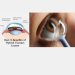 Benefits of Hybrid Contact Lenses