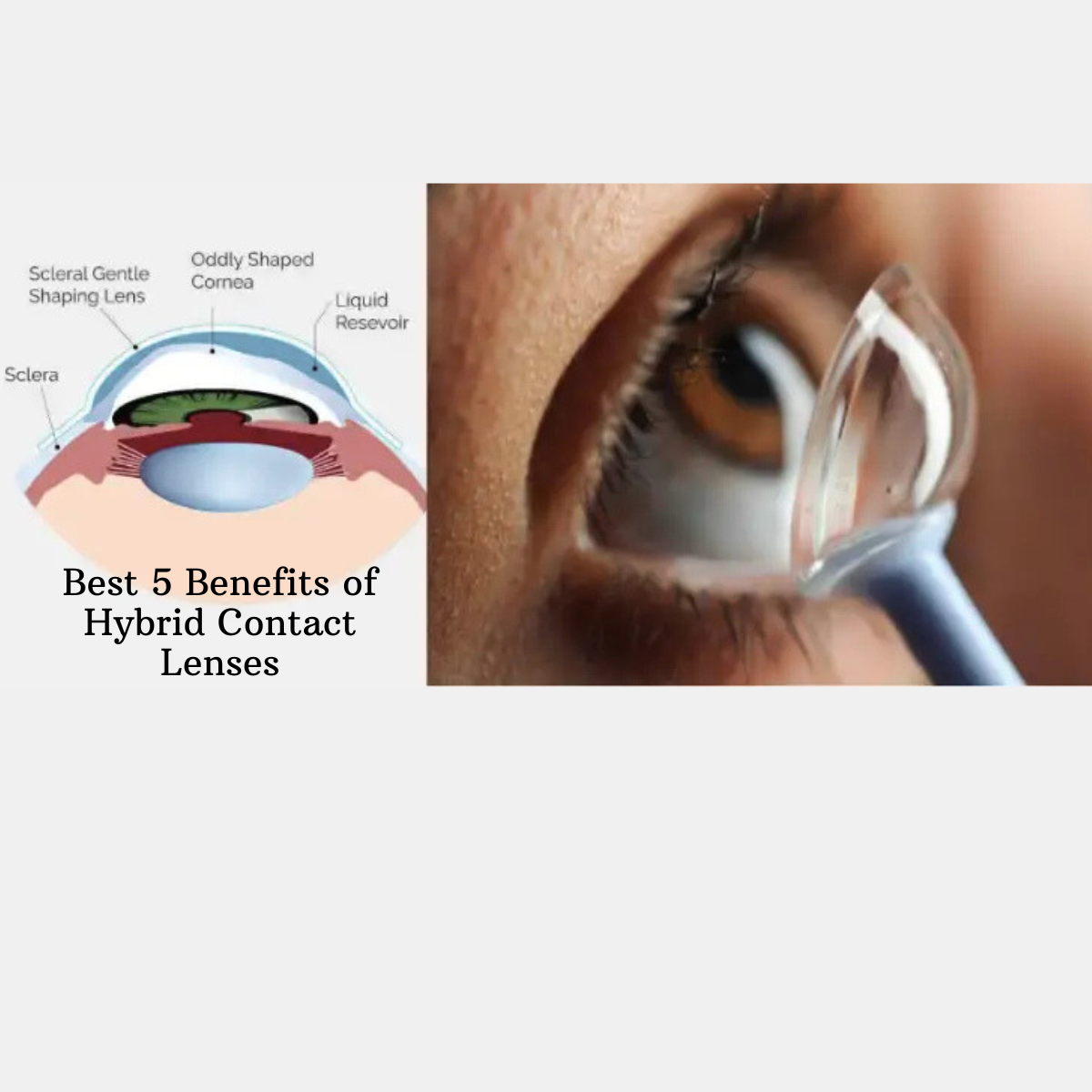 Benefits of Hybrid Contact Lenses
